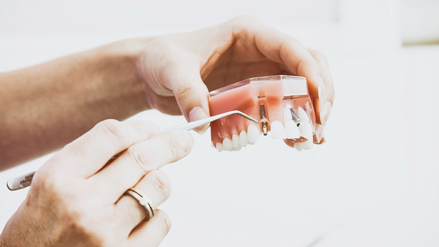 طراحی لبخند دیجیتال